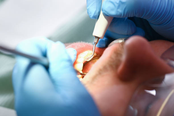 Best Emergency Tooth Extraction  in Mcguire Af, NJ